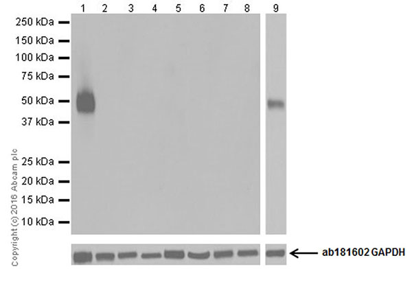 Western blot - Anti-CD4 antibody [EPR19533] (AB183686)