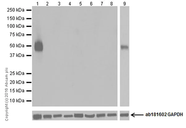 Western blot - Anti-CD4 antibody [EPR19533] - BSA and Azide free (AB250678)