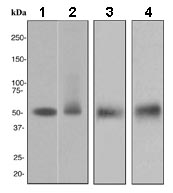 Western blot - Anti-CD4 antibody [EPR3942] (AB133313), expandable thumbnail