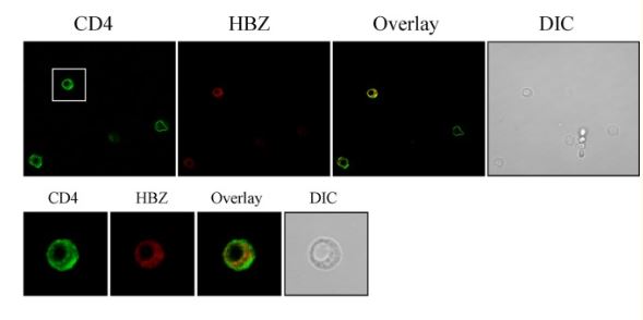 Immunocytochemistry/ Immunofluorescence - Anti-CD4 antibody [EPR6855] (AB133616), expandable thumbnail