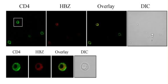 Immunocytochemistry/ Immunofluorescence - Anti-CD4 antibody [EPR6855] (AB133616)