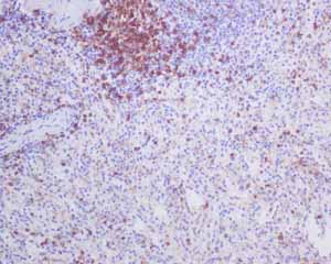 Immunohistochemistry (Formalin/PFA-fixed paraffin-embedded sections) - Anti-CD4 antibody [EPR6855] (ab133616), expandable thumbnail