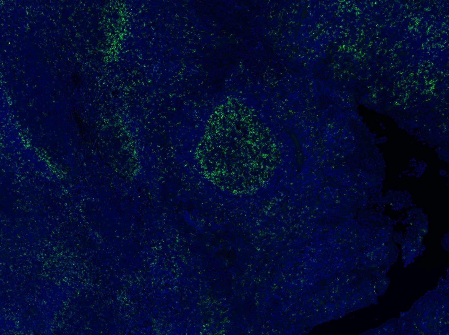 Immunohistochemistry (Formalin/PFA-fixed paraffin-embedded sections) - Anti-CD4 antibody [EPR6855] (AB133616), expandable thumbnail
