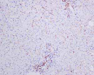 Immunohistochemistry (Formalin/PFA-fixed paraffin-embedded sections) - Anti-CD4 antibody [EPR6855] (ab133616), expandable thumbnail