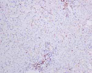 Immunohistochemistry (Formalin/PFA-fixed paraffin-embedded sections) - Anti-CD4 antibody [EPR6855] (AB133616)