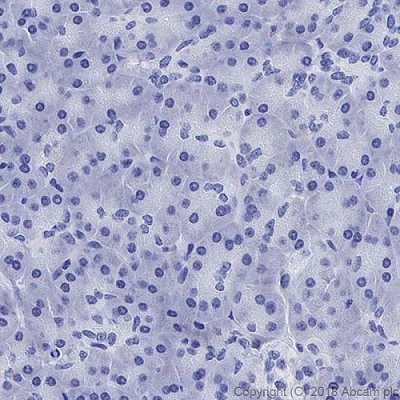 Immunohistochemistry (Formalin/PFA-fixed paraffin-embedded sections) - Anti-CD4 antibody [EPR6855] (ab133616), expandable thumbnail