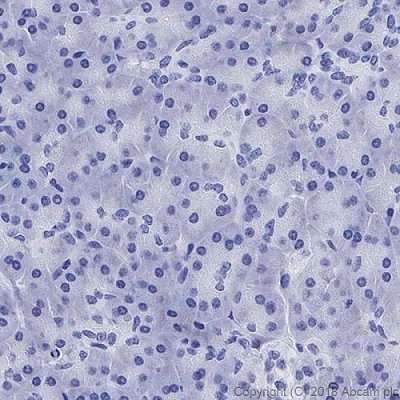 専用ページ Anti-CD4 antibody [EPR6855] 20 ul size (ab133616) | Abcam