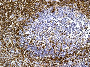 Immunohistochemistry (Formalin/PFA-fixed paraffin-embedded sections) - Anti-CD4 antibody [EPR6855] (ab133616), expandable thumbnail