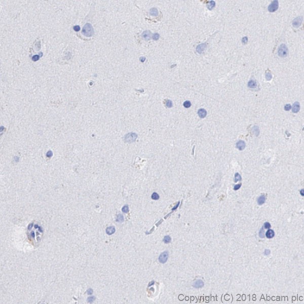 Immunohistochemistry (Formalin/PFA-fixed paraffin-embedded sections) - Anti-CD4 antibody [EPR6855] (ab133616), expandable thumbnail