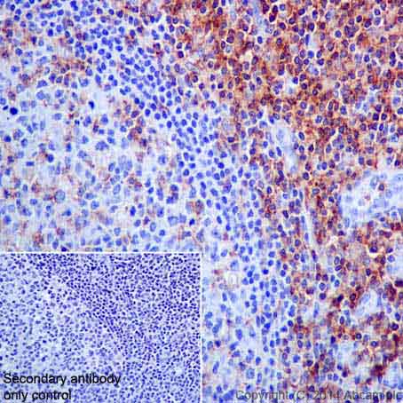 Immunohistochemistry (Formalin/PFA-fixed paraffin-embedded sections) - Anti-CD4 antibody [EPR6855] (AB133616), expandable thumbnail