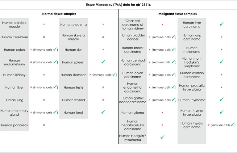 Immunohistochemistry (Formalin/PFA-fixed paraffin-embedded sections) - Anti-CD4 antibody [EPR6855] (AB133616)