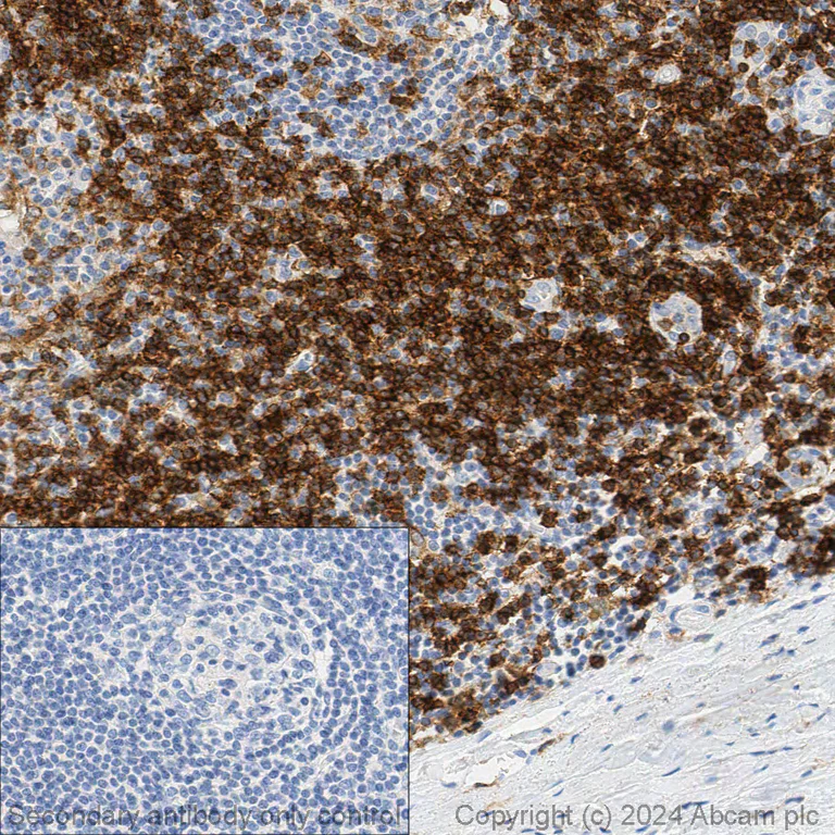 Immunohistochemistry (Formalin/PFA-fixed paraffin-embedded sections) - Anti-CD4 antibody [EPR6855] (AB133616)