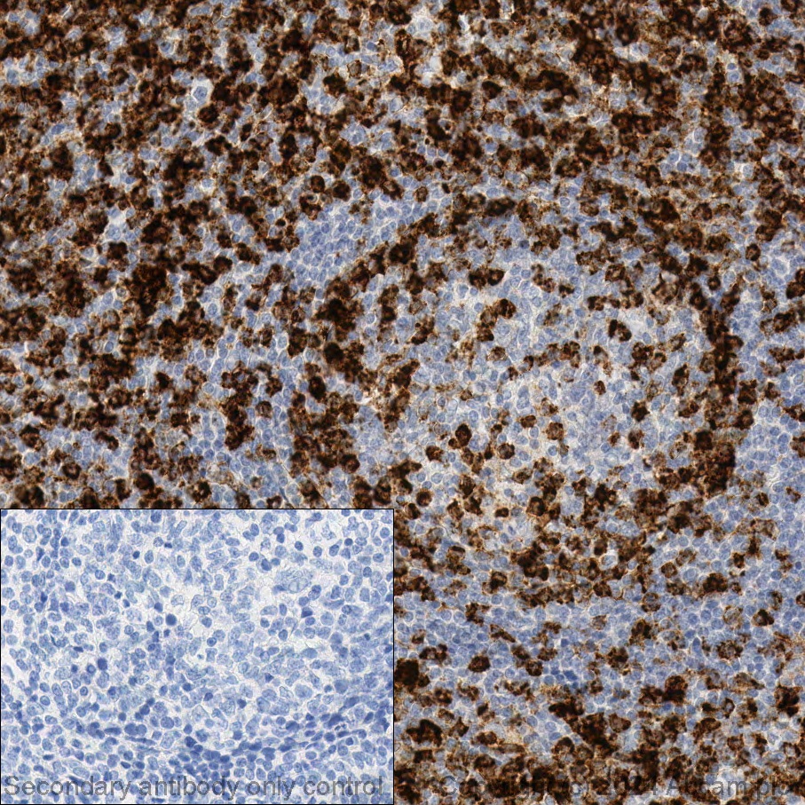 Immunohistochemistry (Formalin/PFA-fixed paraffin-embedded sections) - Anti-CD4 antibody [EPR6855] (ab133616), expandable thumbnail