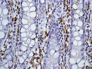 Immunohistochemistry (Formalin/PFA-fixed paraffin-embedded sections) - Anti-CD4 antibody [EPR6855] (ab133616), expandable thumbnail
