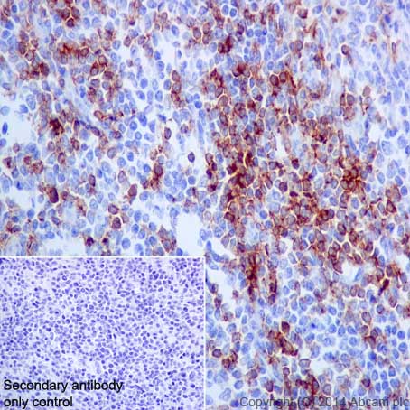 Immunohistochemistry (Formalin/PFA-fixed paraffin-embedded sections) - Anti-CD4 antibody [EPR6855] (ab133616), expandable thumbnail