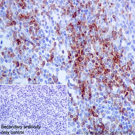 Immunohistochemistry (Formalin/PFA-fixed paraffin-embedded sections) - Anti-CD4 antibody [EPR6855] (AB133616)