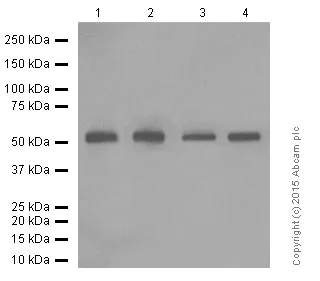 Western blot - Anti-CD4 antibody [EPR6855] (AB133616)