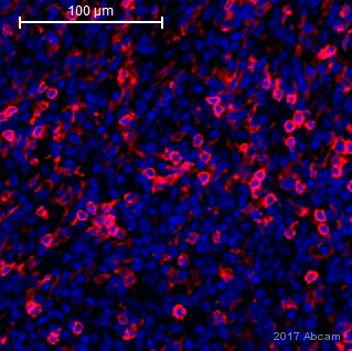 Immunohistochemistry (Formalin/PFA-fixed paraffin-embedded sections) - Anti-CD4 antibody [EPR6855] - BSA and Azide free (AB181724)