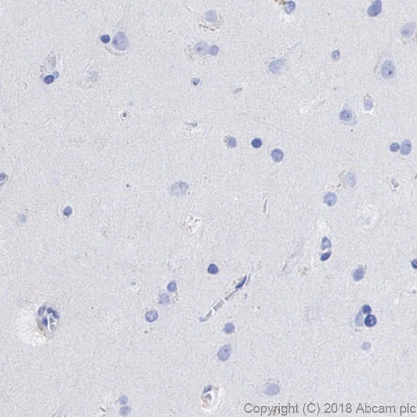 Immunohistochemistry (Formalin/PFA-fixed paraffin-embedded sections) - Anti-CD4 antibody [EPR6855] - BSA and Azide free (AB181724)