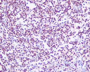 Immunohistochemistry (Formalin/PFA-fixed paraffin-embedded sections) - Anti-CD4 antibody [EPR6855] - BSA and Azide free (AB181724)
