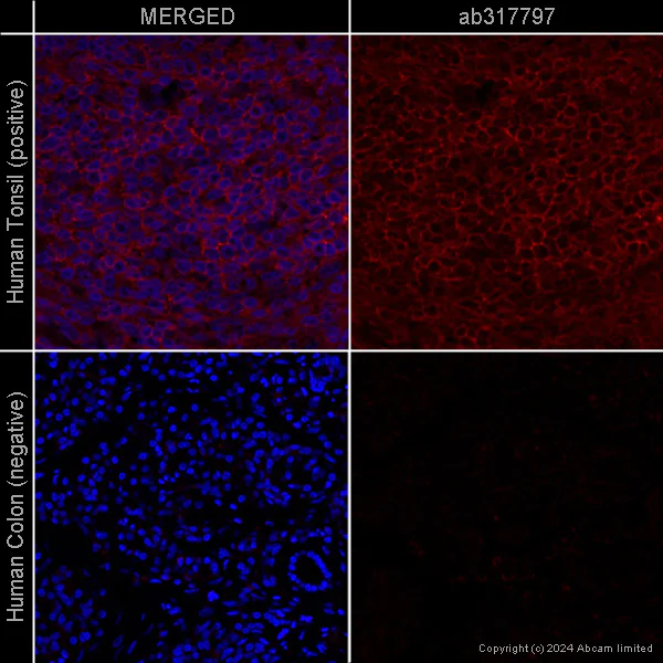 Immunohistochemistry (Formalin/PFA-fixed paraffin-embedded sections) - Anti-CD4 antibody [EPR6855] – Mouse IgG1 (Chimeric) – BSA and Azide Free (AB317797)