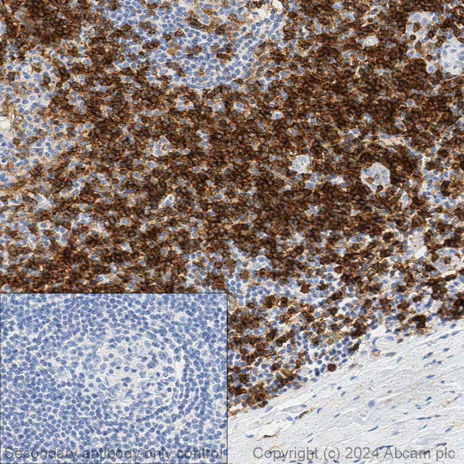 Immunohistochemistry (Formalin/PFA-fixed paraffin-embedded sections) - Anti-CD4 antibody [EPR6855]  – Mouse IgG1 (Chimeric) – BSA and Azide Free (AB317797), expandable thumbnail