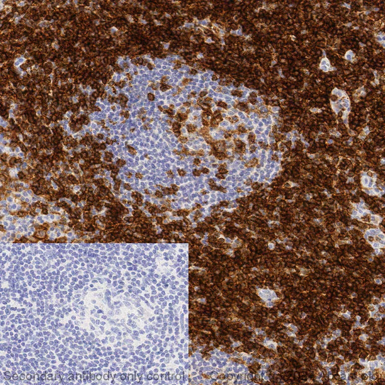 Immunohistochemistry (Formalin/PFA-fixed paraffin-embedded sections) - Anti-CD4 antibody [EPR6855] – Mouse IgG1 (Chimeric) – BSA and Azide Free (AB317797)