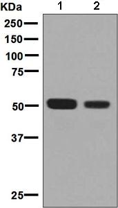 Western blot - Anti-CD4 antibody [EPR7276] (AB133622), expandable thumbnail