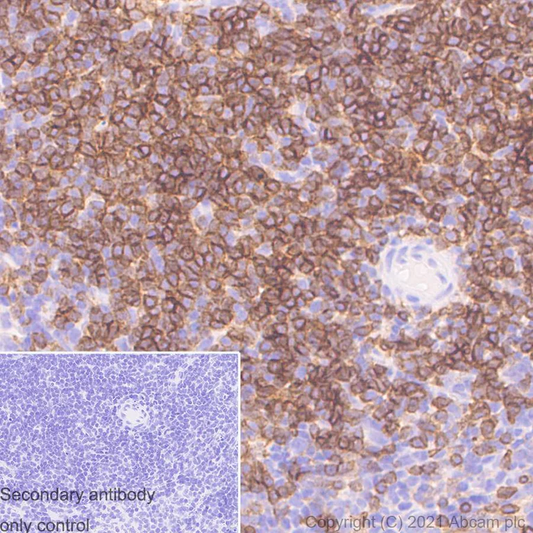 Immunohistochemistry (Formalin/PFA-fixed paraffin-embedded sections) - Anti-CD4 antibody [RM1013] (AB288724)