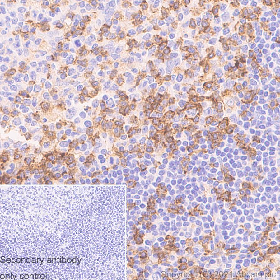 Immunohistochemistry (Formalin/PFA-fixed paraffin-embedded sections) - Anti-CD4 antibody [RM1013] (AB288724), expandable thumbnail