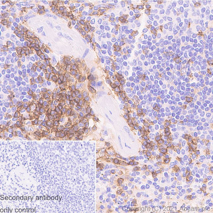 Immunohistochemistry (Formalin/PFA-fixed paraffin-embedded sections) - Anti-CD4 antibody [RM1013] (ab288724), expandable thumbnail