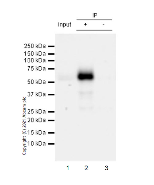 Immunoprecipitation - Anti-CD4 antibody [RM1013] (AB288724), expandable thumbnail
