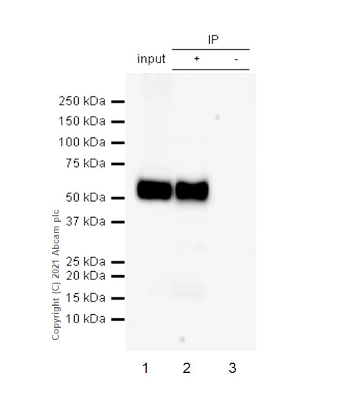 Immunoprecipitation - Anti-CD4 antibody [RM1013] (ab288724), expandable thumbnail