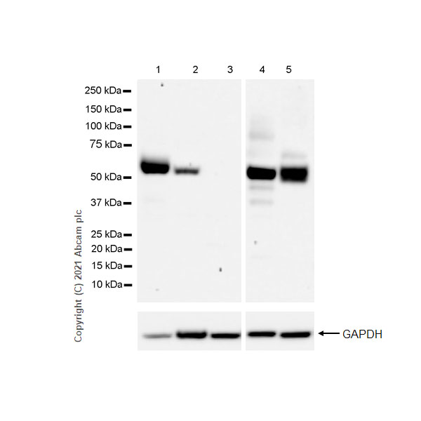 Western blot - Anti-CD4 antibody [RM1013] (AB288724), expandable thumbnail