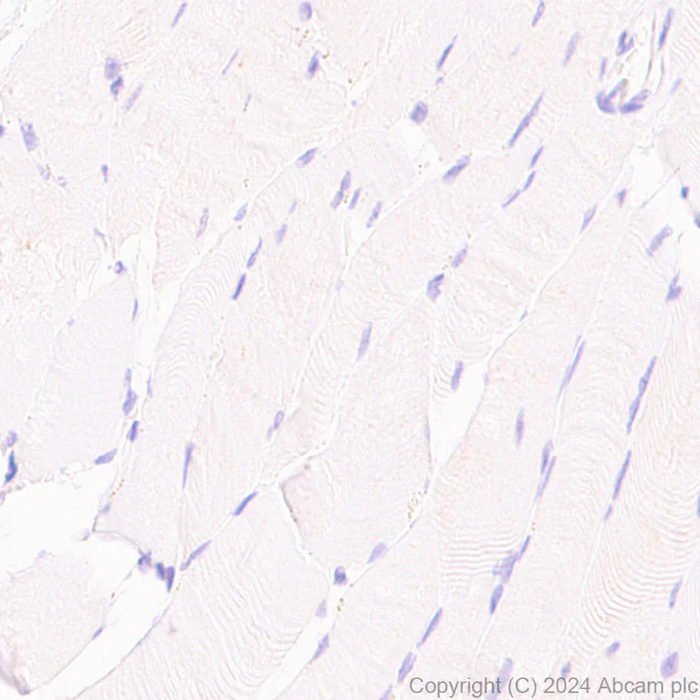 Immunohistochemistry (Formalin/PFA-fixed paraffin-embedded sections) - Anti-CD4 antibody [RM1136] (AB316866)