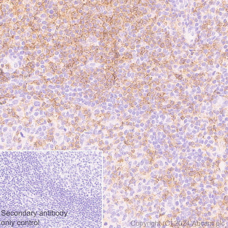 Immunohistochemistry (Formalin/PFA-fixed paraffin-embedded sections) - Anti-CD4 antibody [RM1136] - BSA and Azide free (AB316867)