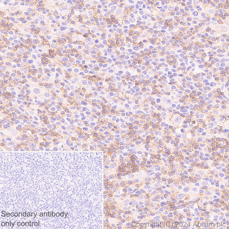 Immunohistochemistry (Formalin/PFA-fixed paraffin-embedded sections) - Anti-CD4 antibody [RM1136] - BSA and Azide free (ab316867), expandable thumbnail