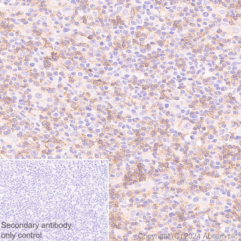 Immunohistochemistry (Formalin/PFA-fixed paraffin-embedded sections) - Anti-CD4 antibody [RM1136] - BSA and Azide free (AB316867)