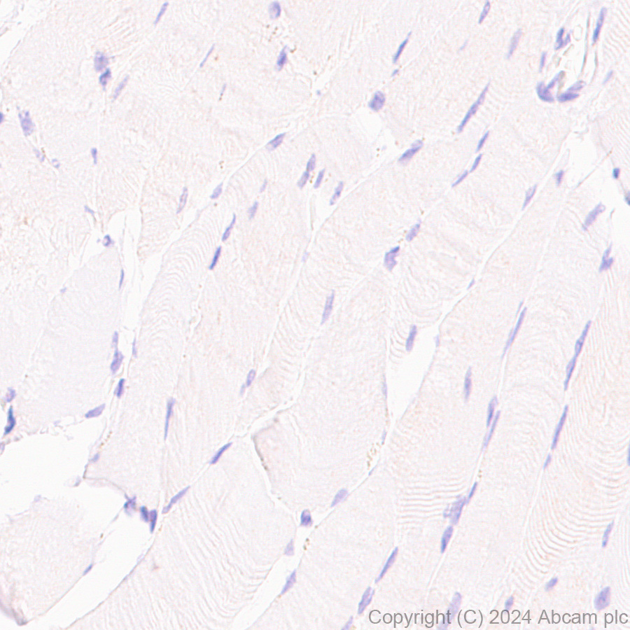 Immunohistochemistry (Formalin/PFA-fixed paraffin-embedded sections) - Anti-CD4 antibody [RM1136] - BSA and Azide free (AB316867), expandable thumbnail