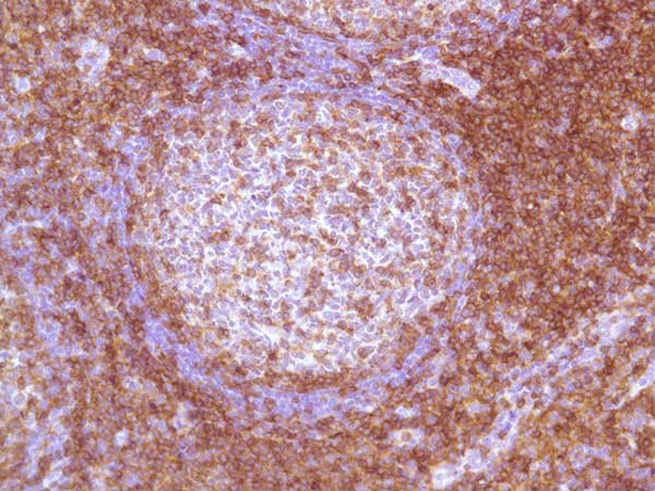 Immunohistochemistry (Formalin/PFA-fixed paraffin-embedded sections) - Anti-CD4 antibody [SP35] (AB213215), expandable thumbnail
