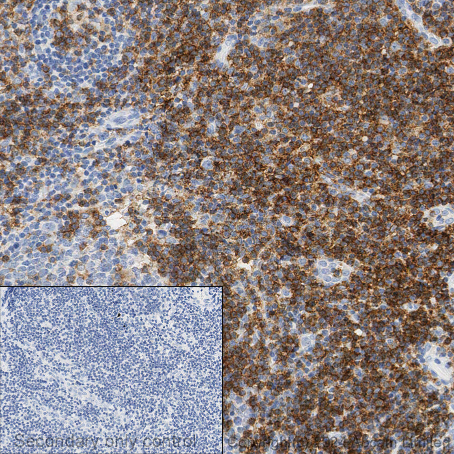 Immunohistochemistry (Formalin/PFA-fixed paraffin-embedded sections) - Anti-CD4 antibody [SP35] (ab213215), expandable thumbnail