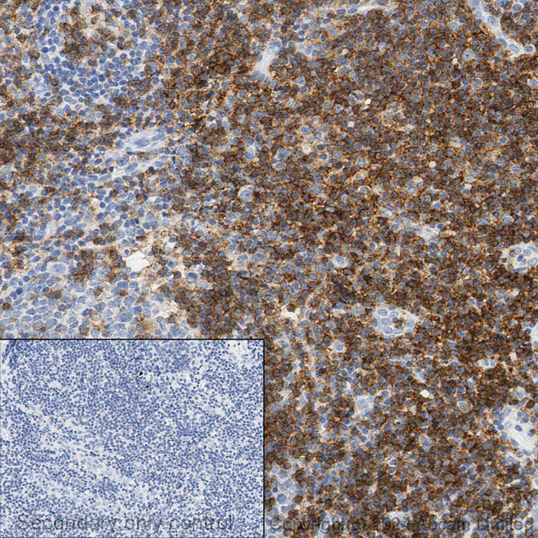 Immunohistochemistry (Formalin/PFA-fixed paraffin-embedded sections) - Anti-CD4 antibody [SP35] (AB213215)