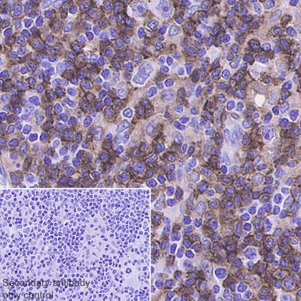 Immunohistochemistry (Formalin/PFA-fixed paraffin-embedded sections) - Anti-CD4 antibody [SP35] (AB213215), expandable thumbnail