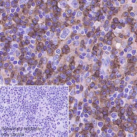 Immunohistochemistry (Formalin/PFA-fixed paraffin-embedded sections) - Anti-CD4 antibody [SP35] (AB213215)