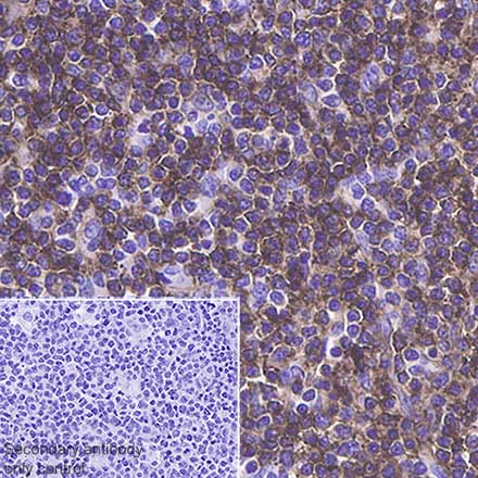 Immunohistochemistry (Formalin/PFA-fixed paraffin-embedded sections) - Anti-CD4 antibody [SP35] (AB213215), expandable thumbnail