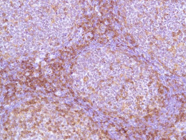 Immunohistochemistry (Formalin/PFA-fixed paraffin-embedded sections) - Anti-CD4 antibody [SP35] (ab213215), expandable thumbnail