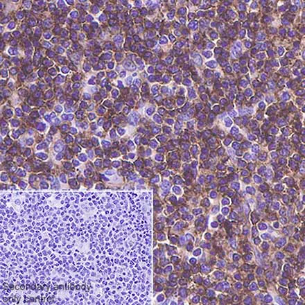 Immunohistochemistry (Formalin/PFA-fixed paraffin-embedded sections) - Anti-CD4 antibody [SP35] - BSA and Azide free (AB238798)