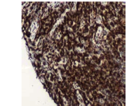 Immunohistochemistry (Formalin/PFA-fixed paraffin-embedded sections) - Anti-CD4 antibody [SP35], prediluted (AB101530), expandable thumbnail