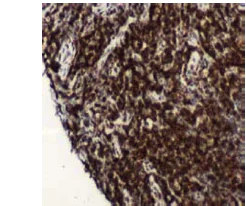 Immunohistochemistry (Formalin/PFA-fixed paraffin-embedded sections) - Anti-CD4 antibody [SP35], prediluted (AB101530)