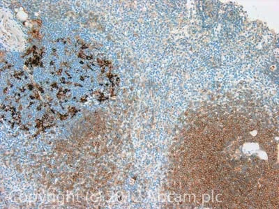 Immunohistochemistry (Formalin/PFA-fixed paraffin-embedded sections) - Anti-CD40 antibody (AB113701)